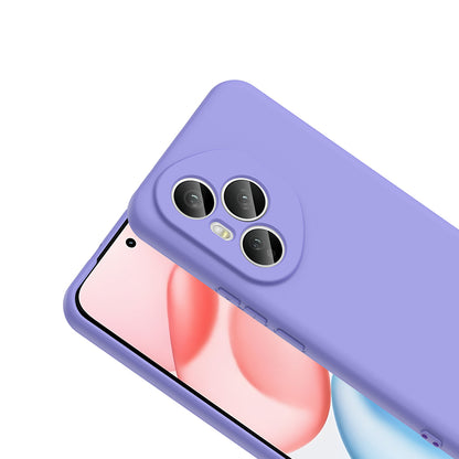 Honor 400 Pro Kılıf Zore Mara Lansman Kapak