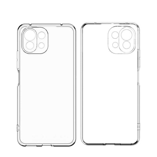 Xiaomi Mi 11 Kılıf Zore Kamera Korumalı Süper Silikon Kapak