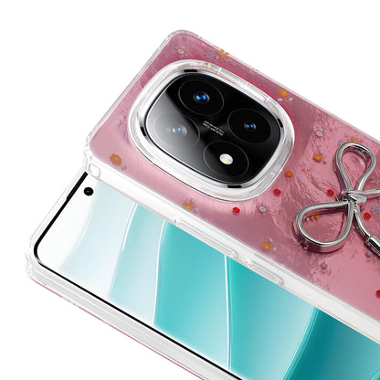 Xiaomi Redmi Note 14 Pro Plus Kılıf Kamera Korumalı Figürlü Zore Ponti Silikon Kapak